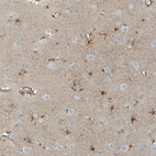 Immunohistochemical staining of human cerebral cortex shows moderate positivity.