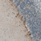 Immunohistochemical staining of human cerebellum shows moderate to strong cytoplasmic positivity in purkinje cells.
