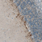 Immunohistochemical staining of human cerebellum shows moderate to strong cytoplasmic positivity in purkinje cells.