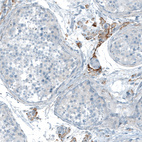 Immunohistochemical staining of human testis shows moderate cytoplasmic positivity in Leydig cells.