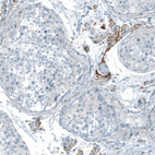 Anti-NLGN3 Antibody