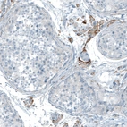 Immunohistochemical staining of human testis shows moderate cytoplasmic positivity in Leydig cells.