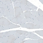 Immunohistochemical staining of human skeletal muscle shows no cytoplasmic positivity in myocytes.