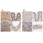 Anti-MED12 Antibody