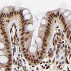 Immunohistochemical staining of human colon using Anti-MED12 antibody HPA003184.