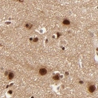 Immunohistochemical staining of human cerebral cortex using Anti-MED12 antibody HPA003184.