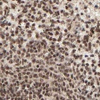 Anti-MED12 Antibody