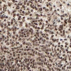 Immunohistochemical staining of human spleen using Anti-MED12 antibody HPA003184.