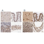 Immunohistochemical staining of human cerebral cortex, colon, spleen and testis using Anti-MED12 antibody HPA003185 (A) shows similar protein distribution across tissues to independent antibody HPA003184 (B).
