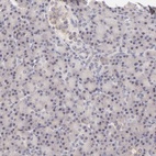 Anti-MED12 Antibody