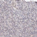 Immunohistochemical staining of human pancreas shows low expression as expected.