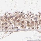 Immunohistochemical staining of human testis using Anti-MED12 antibody HPA003185.