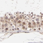 Immunohistochemical staining of human testis using Anti-MED12 antibody HPA003185.