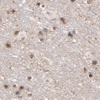 Immunohistochemical staining of human cerebral cortex using Anti-MED12 antibody HPA003185.