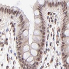 Immunohistochemical staining of human colon using Anti-MED12 antibody HPA003185.