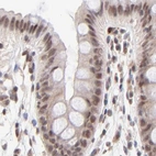 Immunohistochemical staining of human colon using Anti-MED12 antibody HPA003185.