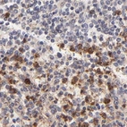 Immunohistochemical staining of human spleen using Anti-MED12 antibody HPA003185.