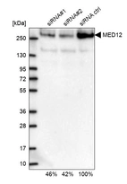 Western blot analysis in U2OS cells transfected with control siRNA, target specific siRNA probe #1 and #2, using Anti-MED12 antibody. Remaining relative intensity is presented.