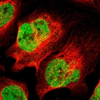 Immunofluorescent staining of human cell line U-2 OS shows localization to nucleoplasm.