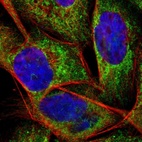 Immunofluorescent staining of human cell line A-431 shows localization to mitochondria.