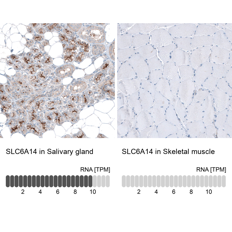 Anti-SLC6A14 Antibody