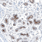 Anti-SLC6A14 Antibody