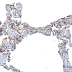Immunohistochemical staining of human lung shows moderate membranous positivity in pneumocytes.