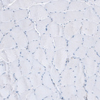 Immunohistochemical staining of human skeletal muscle shows no positivity in myocytes as expected.