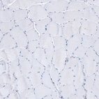 Immunohistochemical staining of human skeletal muscle shows no positivity in myocytes as expected.