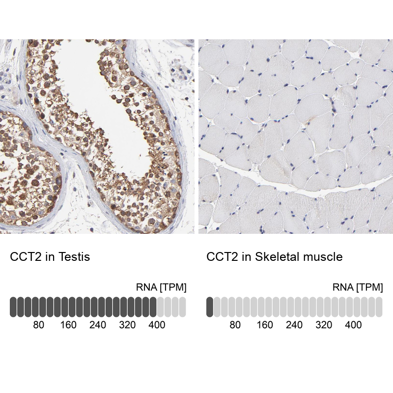 Anti-CCT2 Antibody