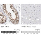 Anti-CCT2 Antibody