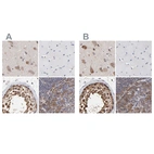 Immunohistochemical staining of human cerebral cortex, skeletal muscle, testis and tonsil using Anti-CCT2 antibody HPA003197 (A) shows similar protein distribution across tissues to independent antibody HPA003198 (B).