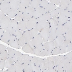 Immunohistochemical staining of human skeletal muscle shows low expression as expected.