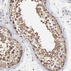 Anti-CCT2 Antibody