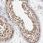 Immunohistochemical staining of human testis shows high expression.