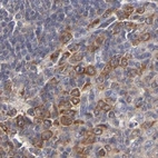 Immunohistochemical staining of human tonsil using Anti-CCT2 antibody HPA003197.