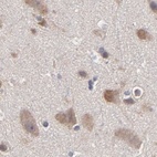 Anti-CCT2 Antibody