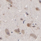 Immunohistochemical staining of human cerebral cortex using Anti-CCT2 antibody HPA003197.