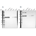 Anti-CCT2 Antibody