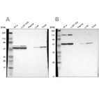 Western blot analysis using Anti-CCT2 antibody HPA003197 (A) shows similar pattern to independent antibody HPA003198 (B).