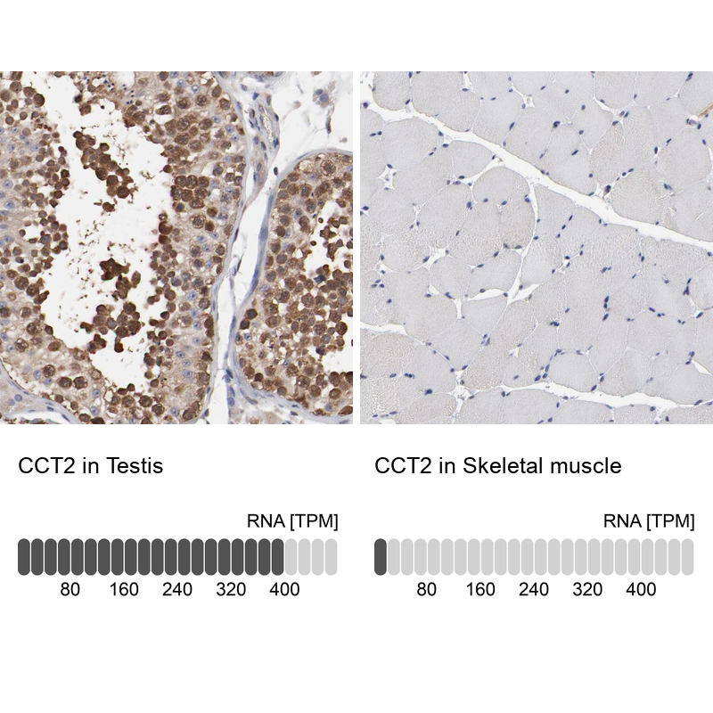 Anti-CCT2 Antibody