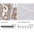 Anti-CCT2 Antibody