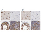 Anti-CCT2 Antibody