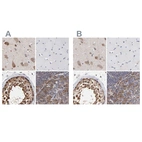 Immunohistochemical staining of human cerebral cortex, skeletal muscle, testis and tonsil using Anti-CCT2 antibody HPA003198 (A) shows similar protein distribution across tissues to independent antibody HPA003197 (B).