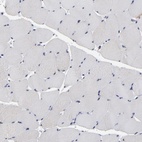 Anti-CCT2 Antibody