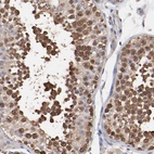 Anti-CCT2 Antibody