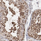 Immunohistochemical staining of human testis shows high expression.