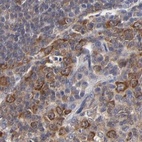 Immunohistochemical staining of human tonsil using Anti-CCT2 antibody HPA003198.