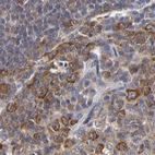 Immunohistochemical staining of human tonsil using Anti-CCT2 antibody HPA003198.
