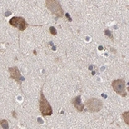 Immunohistochemical staining of human cerebral cortex using Anti-CCT2 antibody HPA003198.